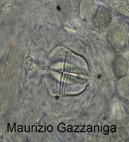 Scheda sui rotiferi